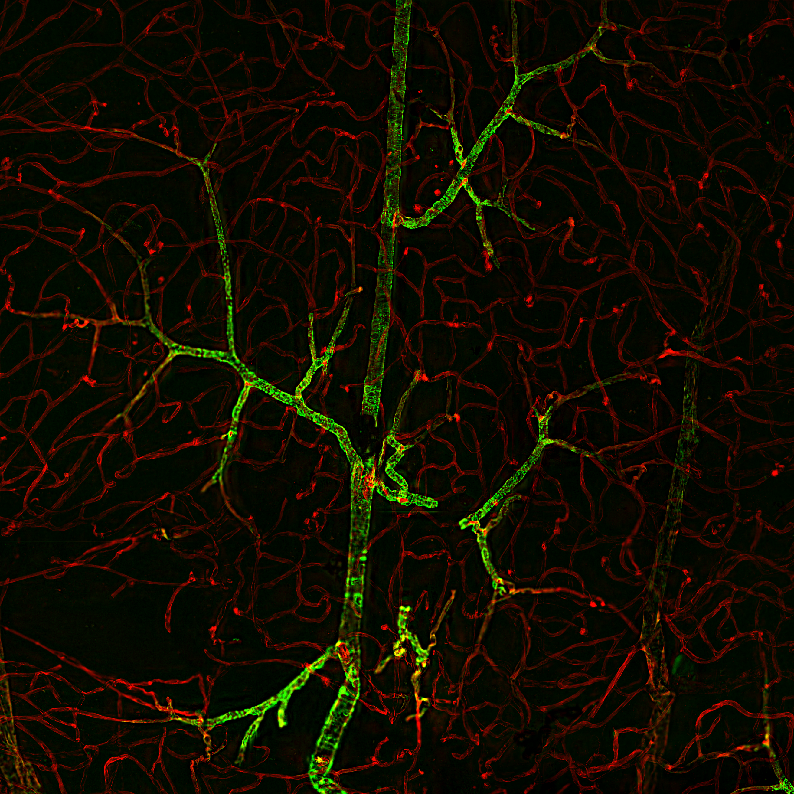 “Seeing” Blood Vessels